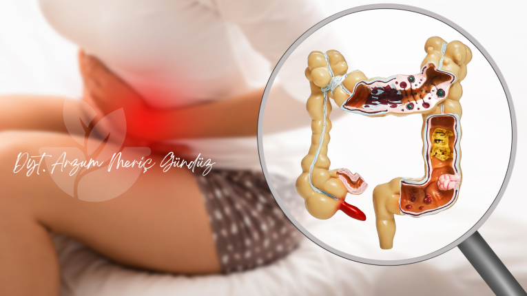 Darıca Diyetisyen Meriç Gündüz ile sağlıklı yaşam ve fiziksel aktivite önerileri. En iyi diyetisyen. Sağlıklı bağırsak için öneriler.
