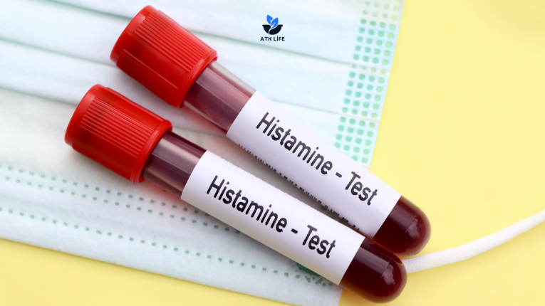 Darıca Diyetisyen Meriç Gündüz Histamine Test